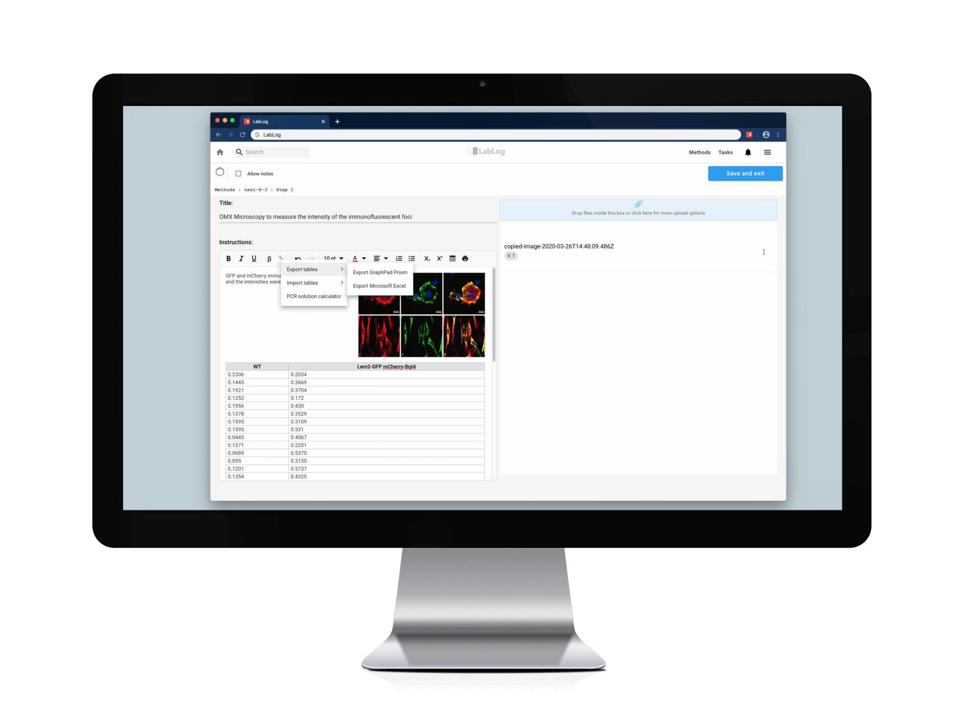 Microscopy Analysis Feature